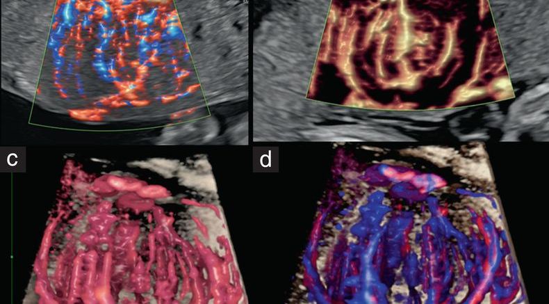 uog24816-fig-0009-m.jpg