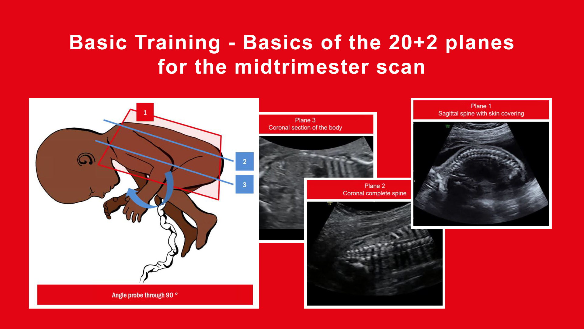 Basics of the 20+2 planes in the mid trimester scan