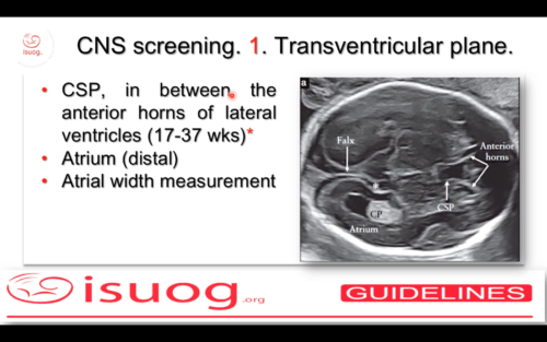 Isuog Practice Guidelines Updated Sonographic Examination Of The