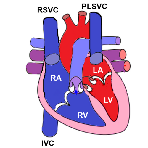 Discover July's Free Access VISUOG Chapter on Persistent Left Superior ...