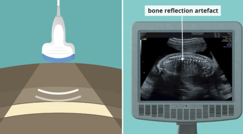 The Principles Of Ultrasound